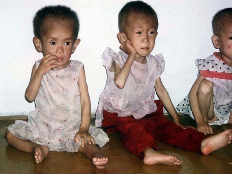 Ngân hàng Thế giới, UNICEF kêu gọi các bước vững chắc để giải quyết tình trạng thiếu dinh dưỡng trẻ em ở Việt Nam.